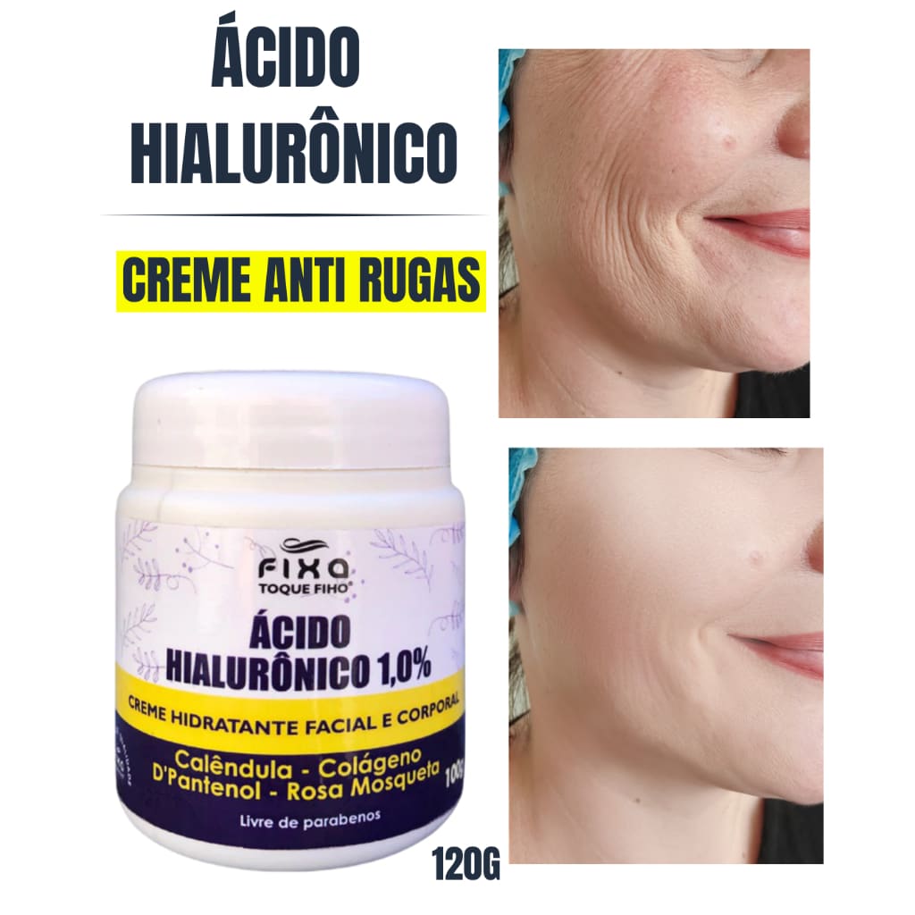 Creme Facial e Corporal Acido Hialurônico Colágeno E Rosa Mosqueta100G Anti Rugas Rejuvenescedor